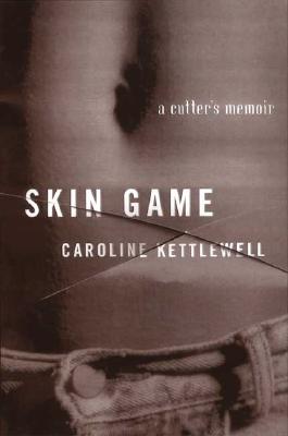 Skin Game: A Memoir