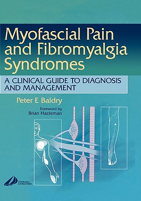 Myofascial Pain and Fibromyalgia Syndromes: A Clinical Guide to Diagnosis and Management