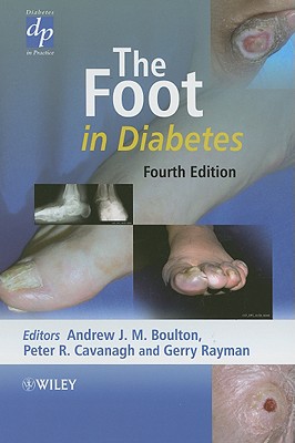 The Foot in Diabetes
