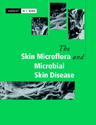 The Skin Microflora and Microbial Skin Disease
