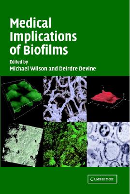 Medical Implications of Biofilms [Hardcover] Wilson, Michael and Devine, Deirdre