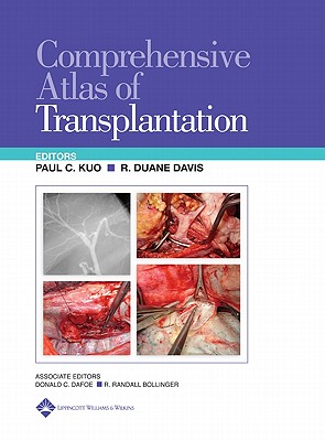 Comprehensive Atlas of Organ Transplantation
