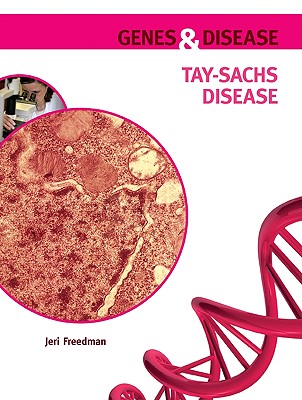 Tay-Sachs Disease (Genes & Disease)