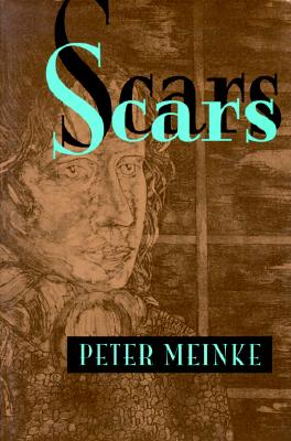 Scars (Pitt Poetry Series)