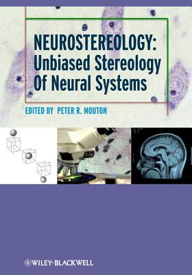 Neurostereology: Unbiased Stereology Of Neural Systems