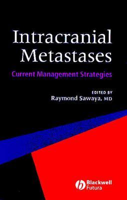 Intracranial Metastases: Current Management Strategies