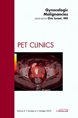 Gynecologic Malignancies, An Issue of PET Clinics (Volume 5-4) (The Clinics: Radiology, Volume 5-4)
