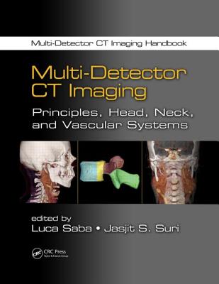 Multi-Detector CT Imaging: Principles, Head, Neck, and Vascular Systems (Multi-Detector CT Imaging Handbook)