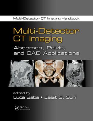 Multi-Detector CT Imaging: Abdomen, Pelvis, and CAD Applications (Multi-Detector CT Imaging Handbook)