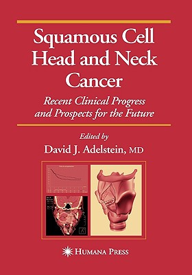 Squamous Cell Head and Neck Cancer: Recent Clinical Progress and Prospects for the Future (Current Clinical Oncology)