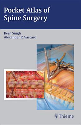 Pocket Atlas of Spine Surgery