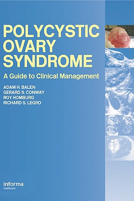 Polycystic Ovary Syndrome: A Guide to Clinical Management
