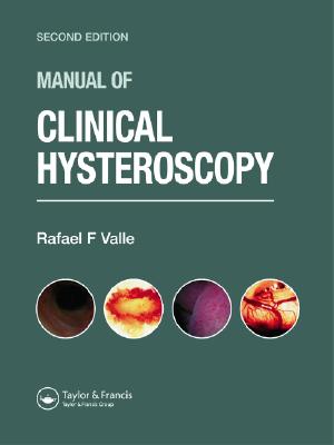Manual of Clinical Hysteroscopy, Second Edition