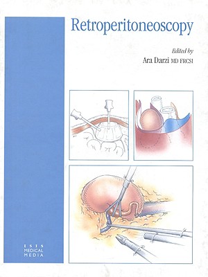 Retroperitoneoscopy