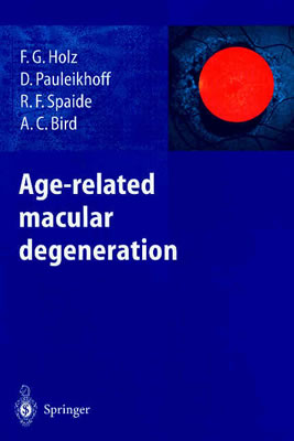Age-related macular degeneration