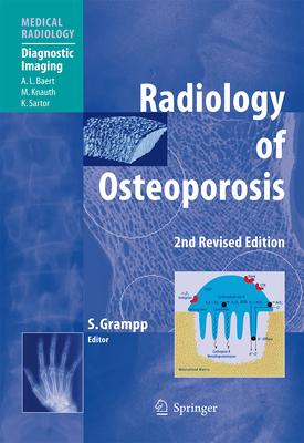 Radiology of Osteoporosis (Diagnostic Imaging)