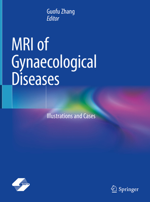 Image for MRI of Gynaecological Diseases: Illustrations and Cases MRI of Gynaecological Diseases: Illustrations and Cases